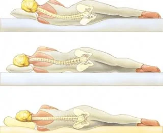 Sleeping Positions 2 Spinal alignment compared across stomach, side and back sleeping positions