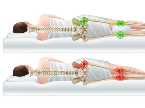 SleepingwithpillowbetweenlegsNorthShoreOsteo